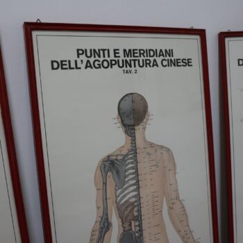 Tris stampe Agopuntura  70s Torino Italy - immagine 3